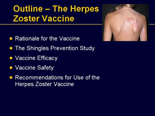 Understanding Herpes Zoster And The Herpes Zoster Vaccine (Slides With ...