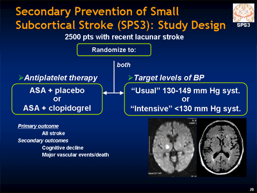 Antiplatelet Therapy for Stroke Prevention (Slides With Transcript)
