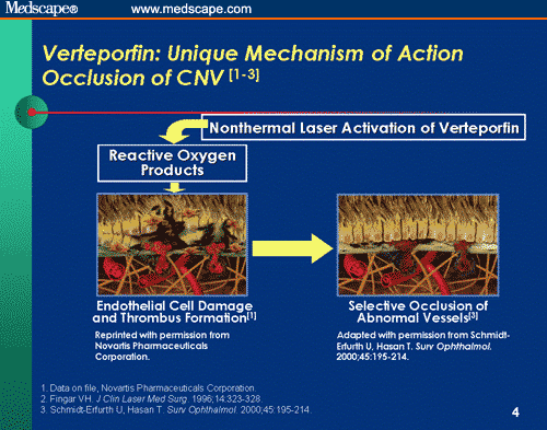 Evaluating the Options for the Treatment of AMD