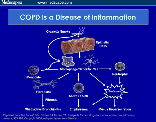 COPD: Awareness, Early Diagnosis, and Intervention