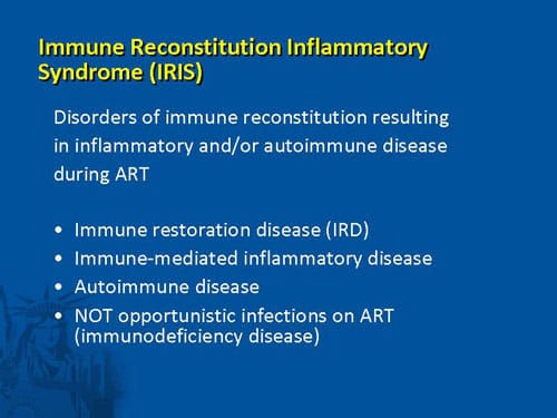 Iris Immune Reconstitution Inflammatory Syndrome www.medscape.org