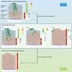 Human Papillomavirus E6/E7 MRNA Testing, Predictive Marker, Cervical Cancer