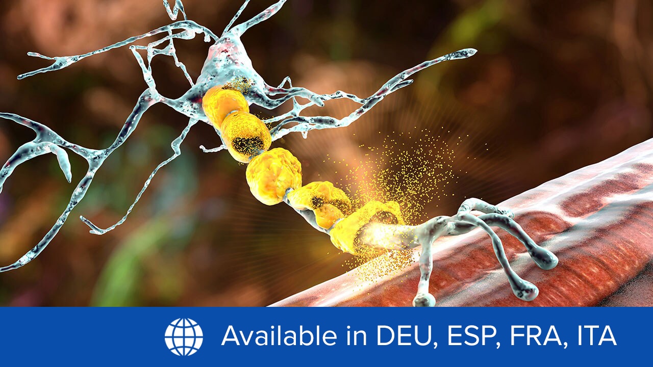 Chronic Inflammatory Demyelinating Polyradiculoneuropathy: Practice  Essentials, Background, Pathophysiology