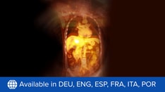 Exploring Novel Combinations in mCRPC Care: Radioligands and Beyond