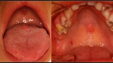 Sexual Abuse: The 'Hidden Pediatric Problem'