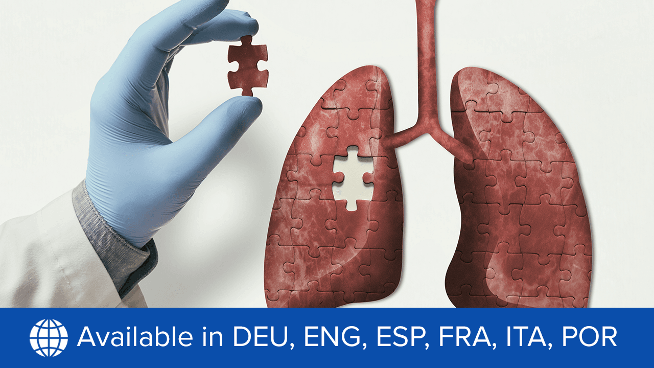 Von der Verschreibung bis zur Praxis bei Atemwegserkrankungen: Hindernisse für die Adhärenz und Compliance von Inhalatoren überwinden