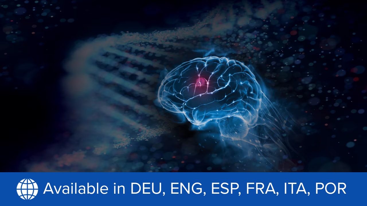 Destaques de São Francisco: O papel em evolução da radioncologia nos cuidados de gliomas de baixo grau