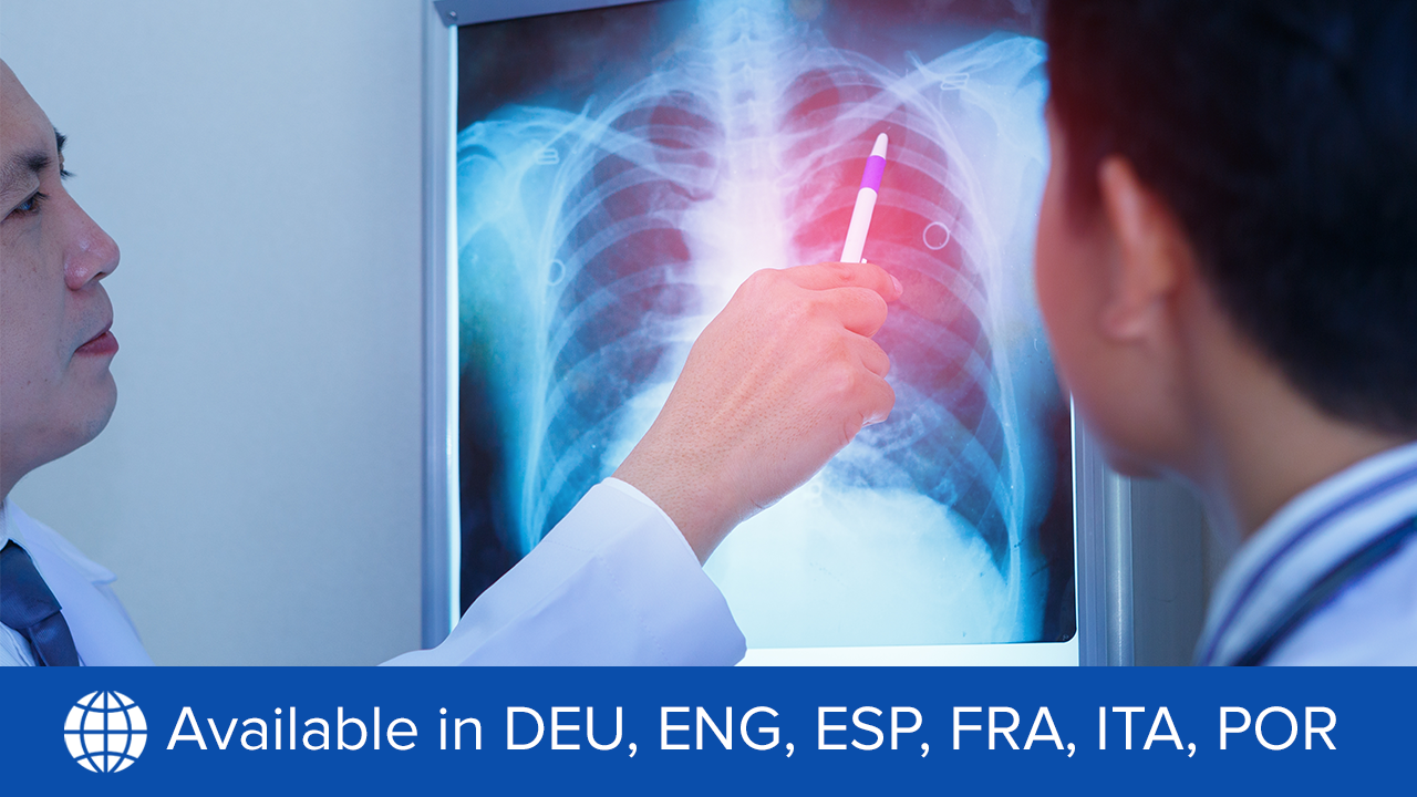 Soins centrés sur la personne dans le CBNPC avancé avec mutation de l’EGFR : Optimiser le pronostic et les expériences