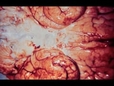 Pediatric Vaccinations: Do You Know the Recommended Schedules?