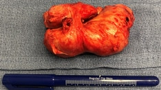 Benign Prostatic Hyperplasia: Evaluation and Treatment