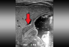 vomiting alkalosis metabolic pathophysiology etiology projectile dilemma osmosis oncology increasingly usmle patients diet ask say boy week