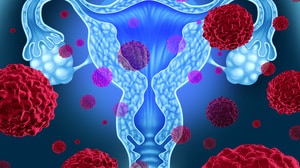 The Evolving Therapeutic Landscapes in Advanced Cervical and Endometrial Cancers