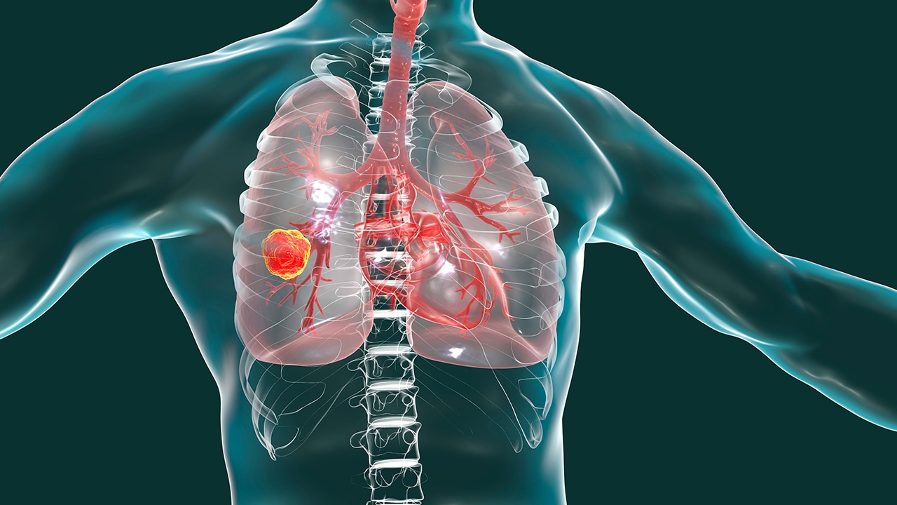 Hypoalbuminemia: Background, Pathophysiology, Etiology