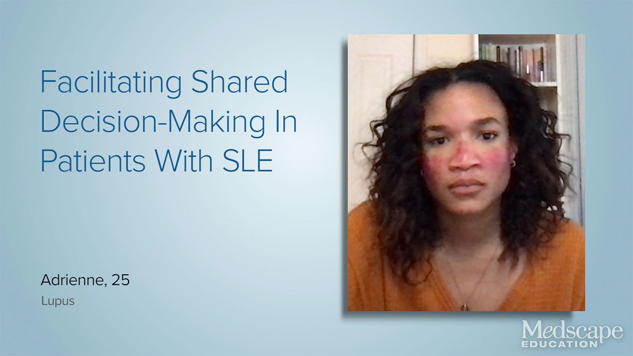 Prednisone Intensol (prednisone) dosing, indications, interactions