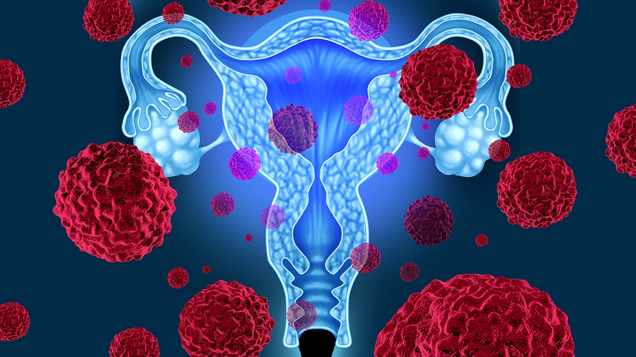 Investigating Cervical Cancer: A Review of Key Data From the Annual European Oncology Meeting