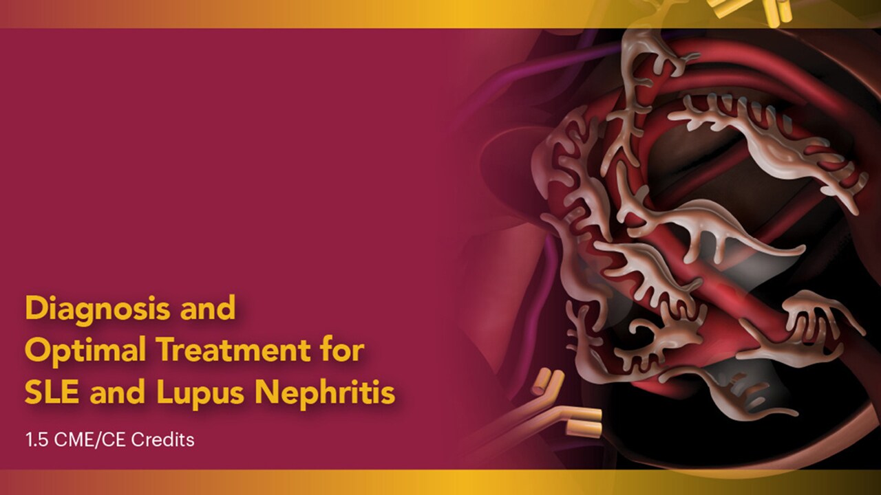 Diagnosis and Optimal Treatment for Systemic Lupus Erythematosus and Lupus Nephritis