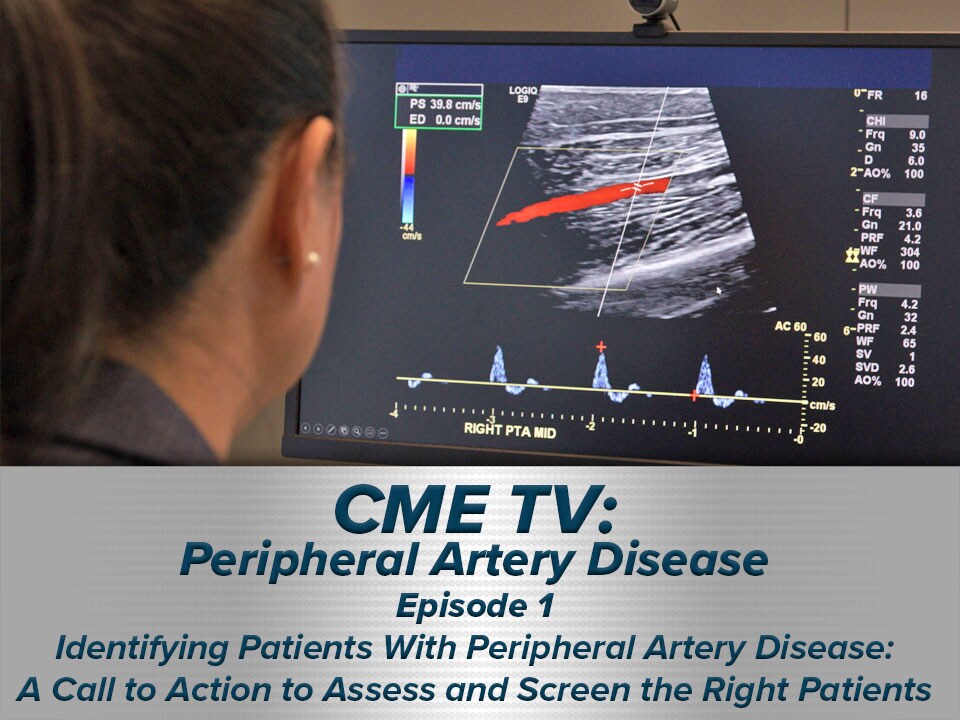 Identifying Patients With Peripheral Artery Disease: A Call to Action to Assess and Screen the Right Patients  