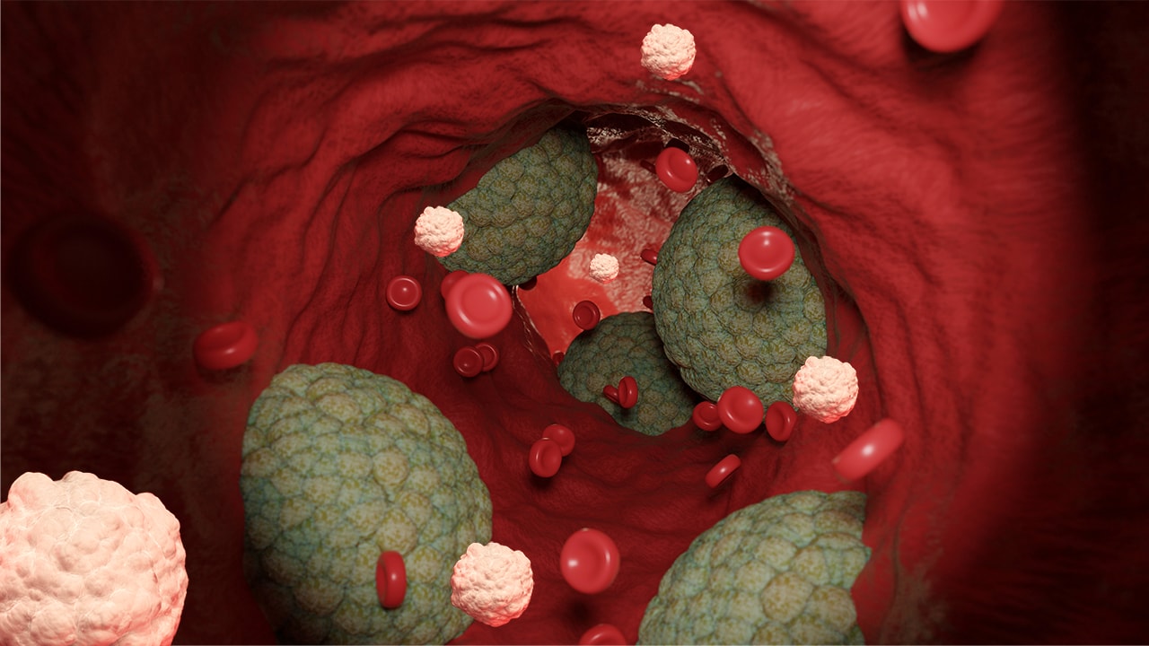 Hot Topics in Cardiovascular Disease: Can Cardiologists Do More to Improve Outcomes in People with Type 2 Diabetes? 