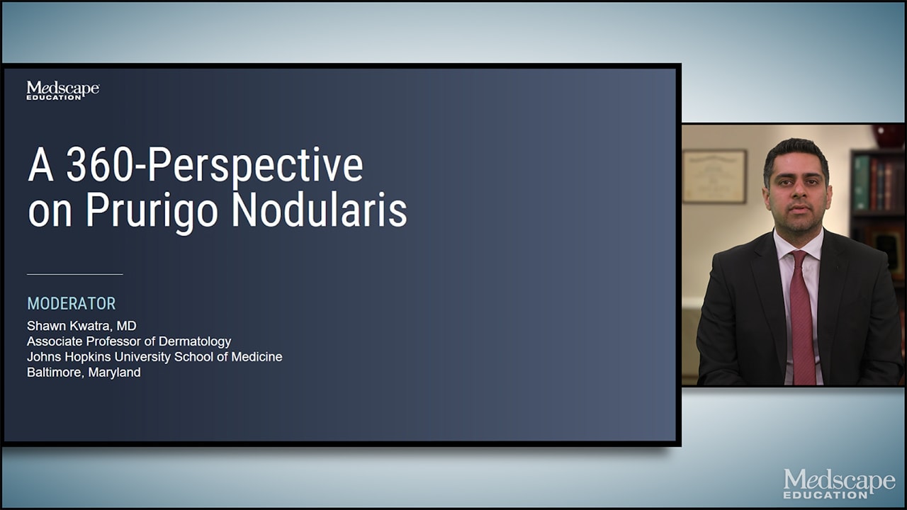 A 360-Perspective on Prurigo Nodularis