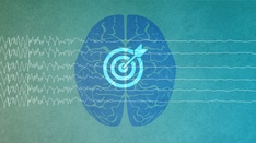 Seizure Action Plans and Rescue Medications in Adults With Epilepsy: Connecting the Dots From Science to Patient Care