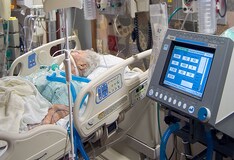 Higher Mortality Rate In Ventilated Covid 19 Patients