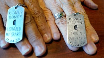 Cystic Fibrosis Medscape