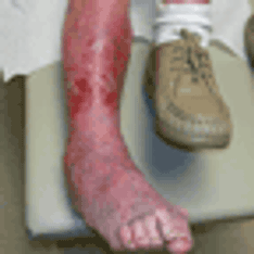 How Do I Differentiate Normal Aging of the Skin From Pathologic Conditions?