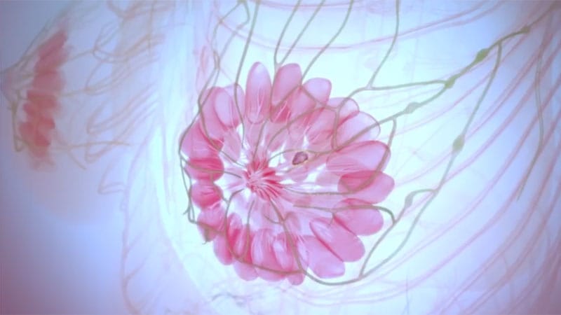 Defining Optimal Therapy in High-Risk Early Breast Cancer