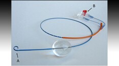 What Lies Ahead for Prehospital Critical Care Resuscitation