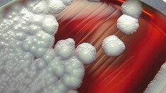 10 Cases of Food Poisoning: Find the Pathogen Responsible