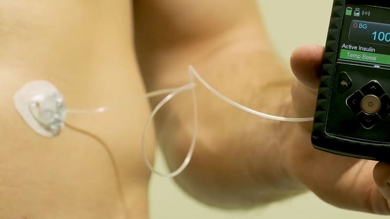 Cardiovascular Risk Reduction: Protecting the Aging Heart: CVD Prevention in Type 2 Diabetes