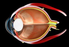 Orbit Anatomy: Osteology, Lacrimal System, Connective Tissue Planes