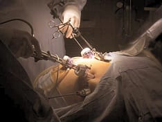 Tips for Monitoring Post-Bariatric Surgery Nutritional Deficiency