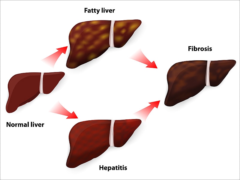 The Liver Meeting 2017: American Association for the Study of Liver ...