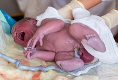 Ring Block Improves Analgesia For Newborn Circumcision
