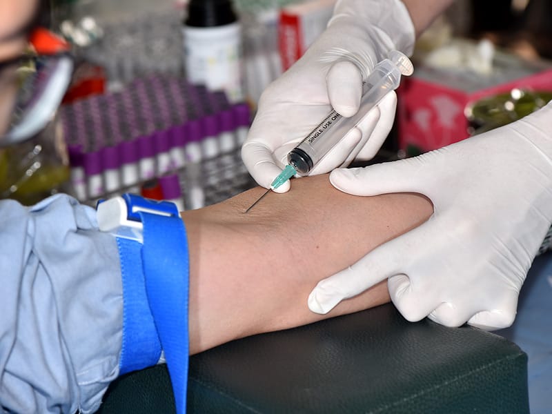 MGUS in 3% of Population: What to Do? 