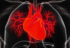 Effient Prasugrel Dosing Indications Interactions Adverse Effects And More