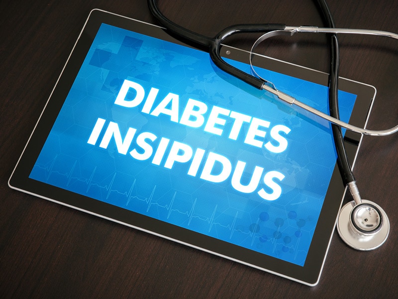 Central Diabetes Insipidus Symptoms Diabetesinsipidus Org