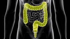 Some Young CRC Patients Are Missing Out on Genetic Counseling, Testing