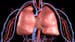 ACE Inhibitors Linked to Higher Lung Cancer Risk
