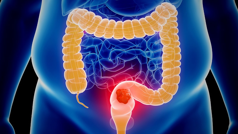 Gastroenterology - Medscape