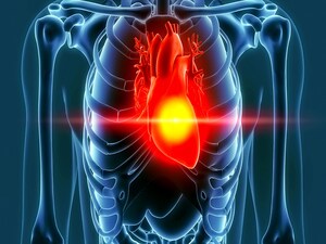 DECLARE-TIMI 58: Dapagliflozin Cuts Heart Failure in Diabetes