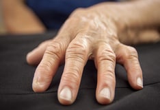 pikkelysömör kezelése timodepresszinnel vörös foltok jelentek meg a kezeken viszketve, mint kezelni