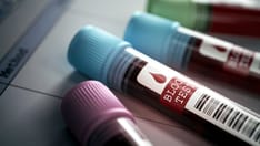 Firefighters Have High Cancer Rates. Is Grail's50-Cancer Blood Test Part of the Solution for First Responders?