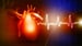 Similar Outcomes With Hearts Donated After Circulatory Death