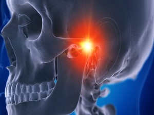 New Guideline for Trigeminal Neuralgia Released