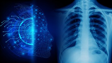 Radiology Medscape