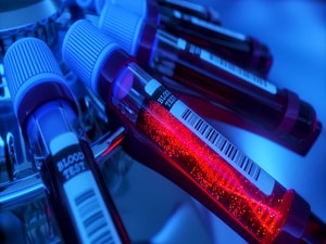 Genetic Tests Prompt Therapy Adjustments in Epilepsy