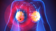 Immunotherapy Active in Early Stage Triple Negative Breast Cancer