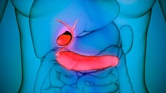 Index Cholecystectomy Cuts Readmissions After Acute Cholangitis